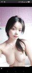 Ngực hs