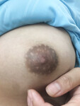 Em gái bị dụ