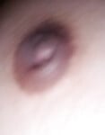Vú to