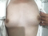 Nứng loll